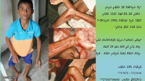 އަޙްޒަމުގެ ފަޔަށް ބޭސްފަރުވާކުރުމުގައި އެހީތެރިކަމަށް ބޭނުންވެފައި